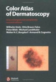 Color Atlas of Dermatoscopy